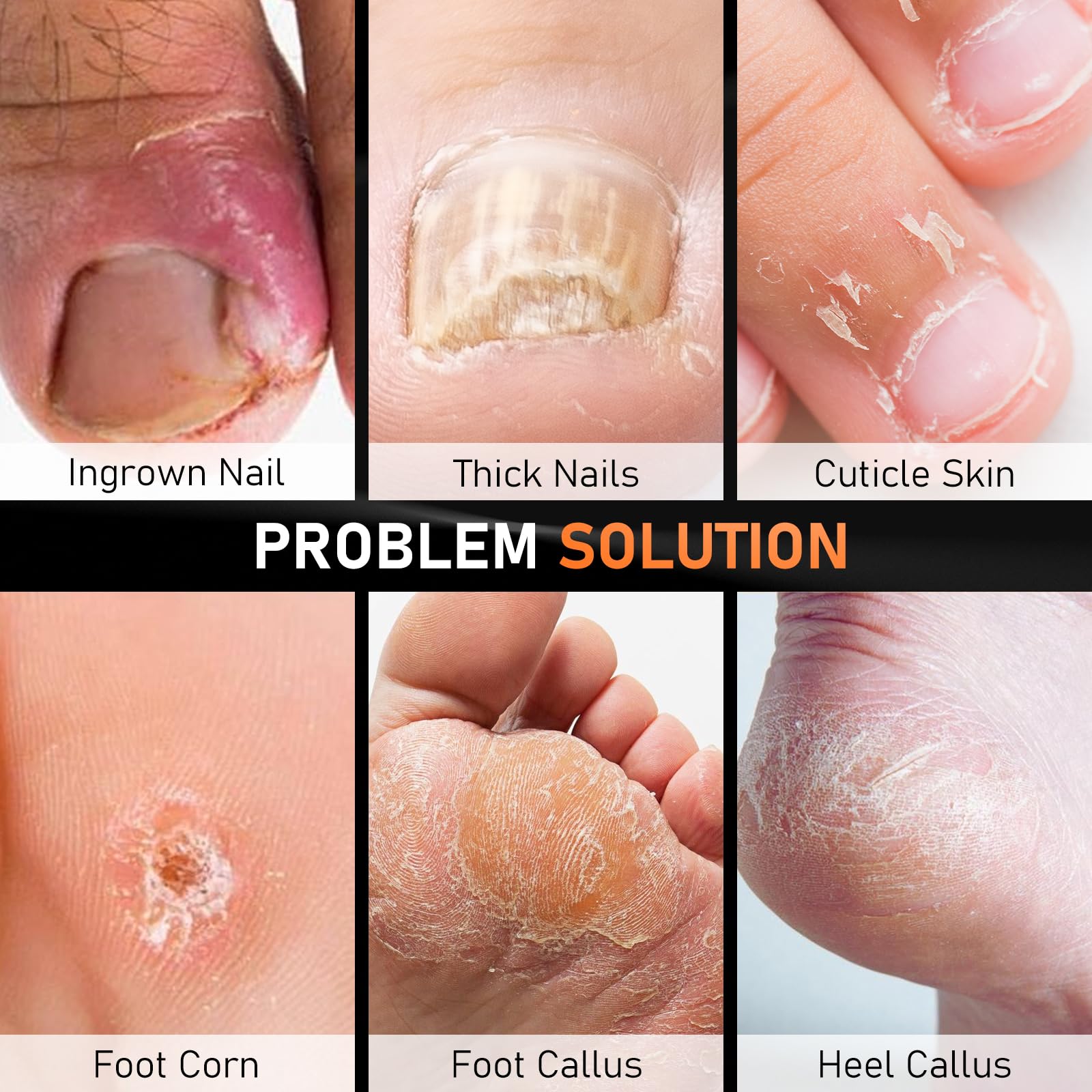 DRMODE foot scraper for dead skin removal