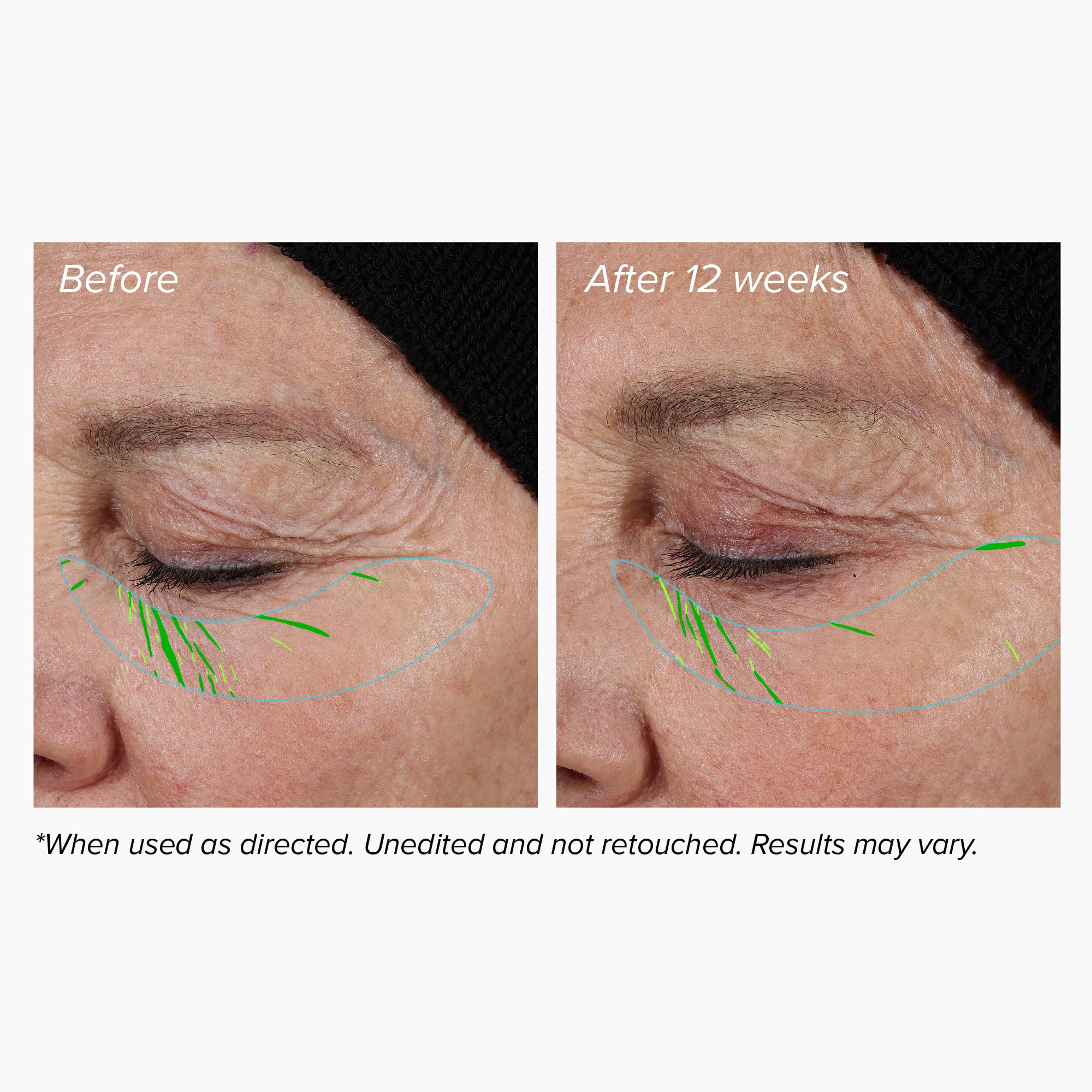 DRMTLGY lifting and firming serum spread on face