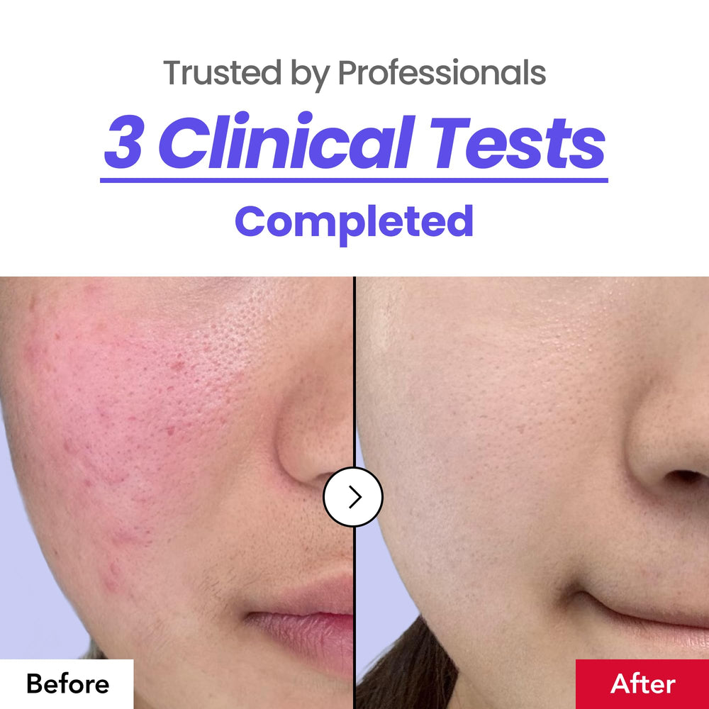 drpercent Calming 64% Cream tube shows protective packaging and freshness