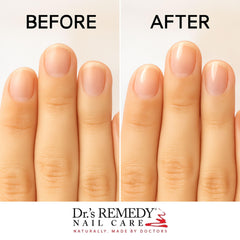 Dr.'s Remedy organic formula featuring nail-strengthening ingredients