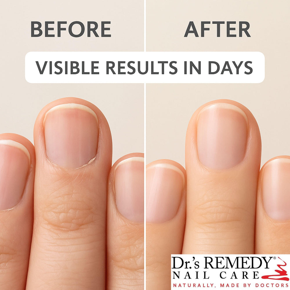 Nourished cuticles from Dr.'s Remedy Cuticle Oil closeup