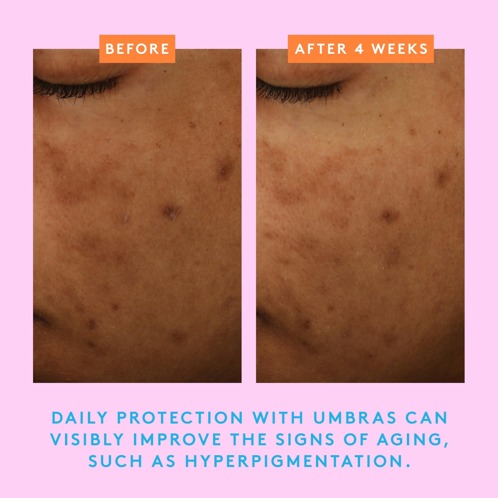 Umbra application close-up on face and neck for everyday sun protection.