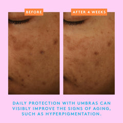 Umbra application close-up on face and neck for everyday sun protection.