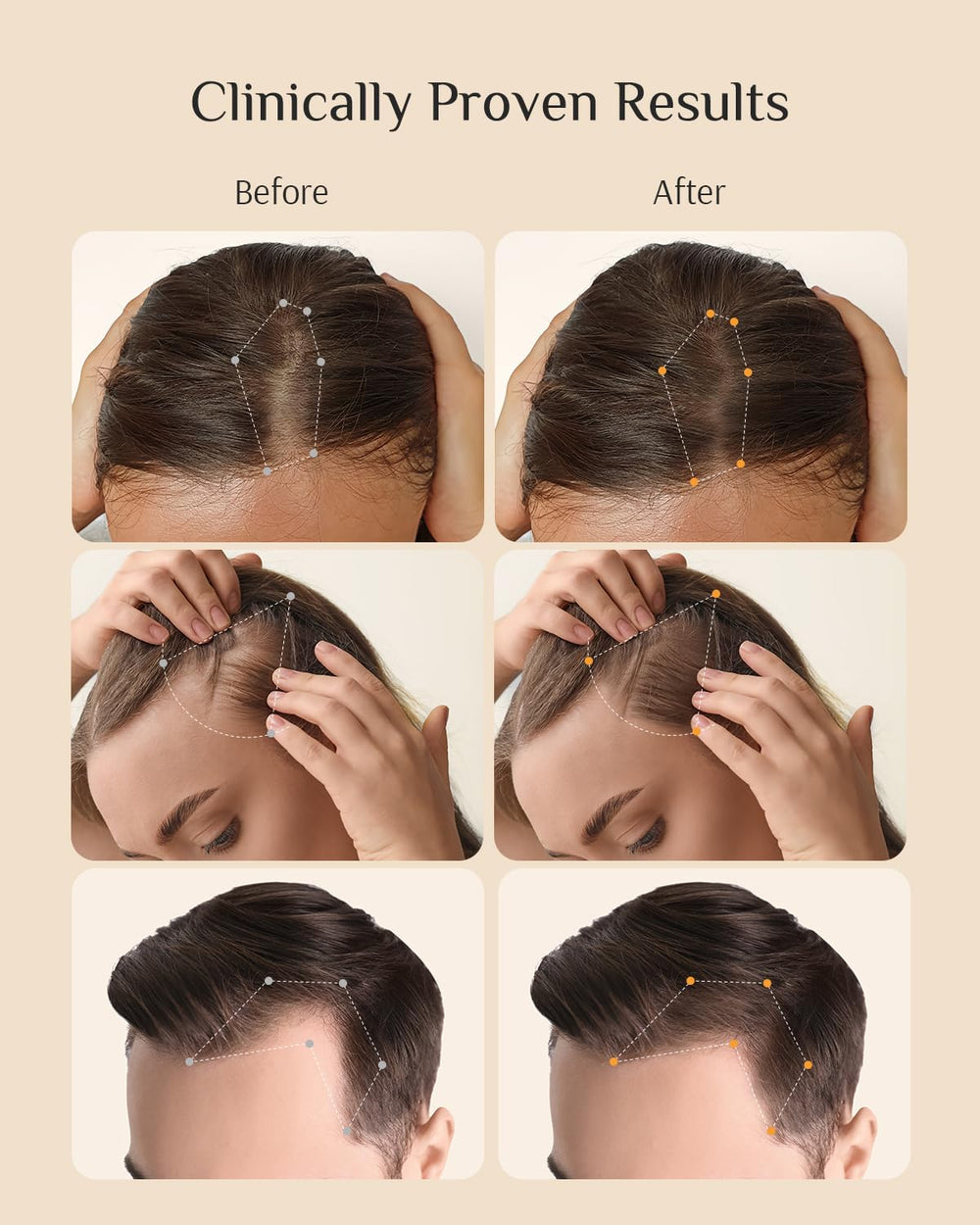 DR ZERO Neology packaging box highlights Redensyl innovation