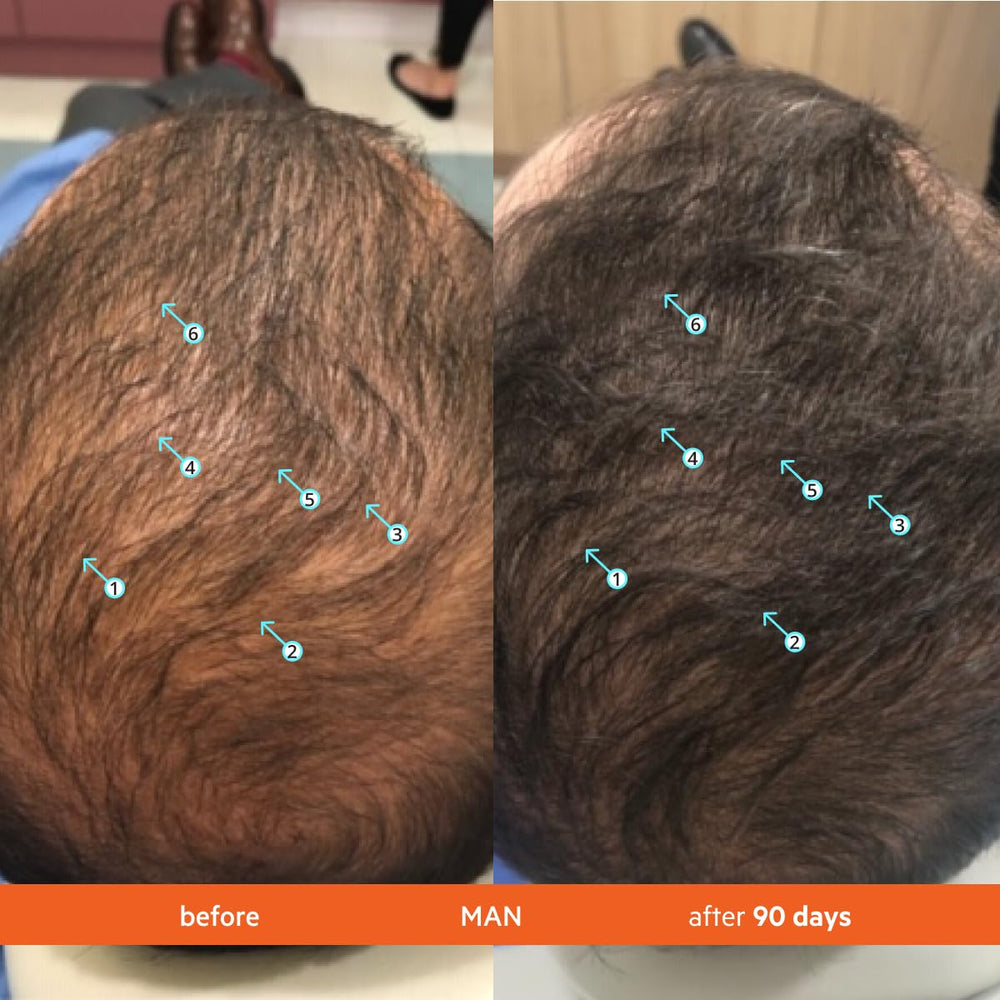 Revita Hair Density capsules close-up with nutrient-rich formula
