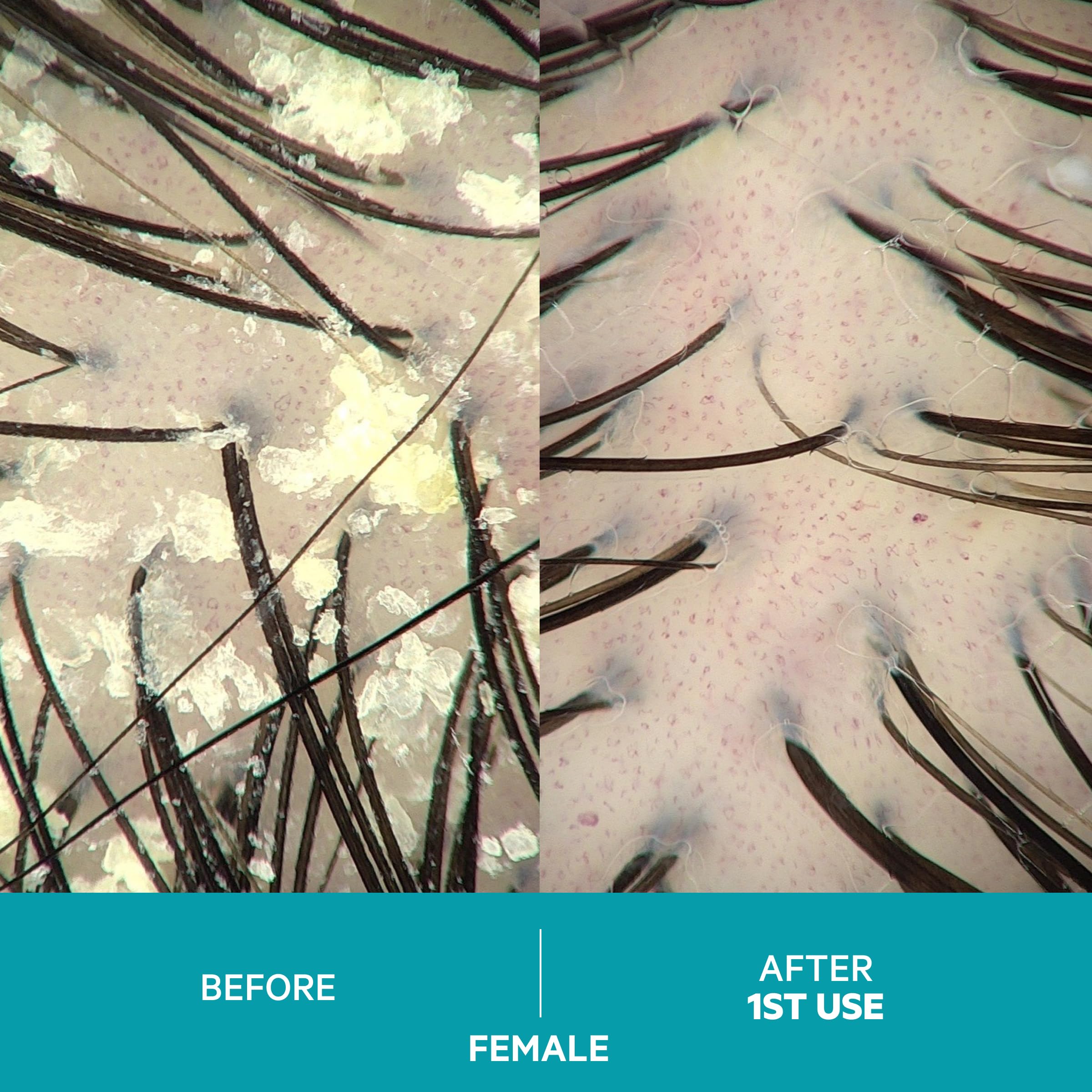 DS Labs Dandrene color-safe icon emphasizes compatibility with dyed hair and vibrant results