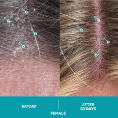 DS Labs Dandrene sulfate-free icon signals gentle cleansing for color-treated hair