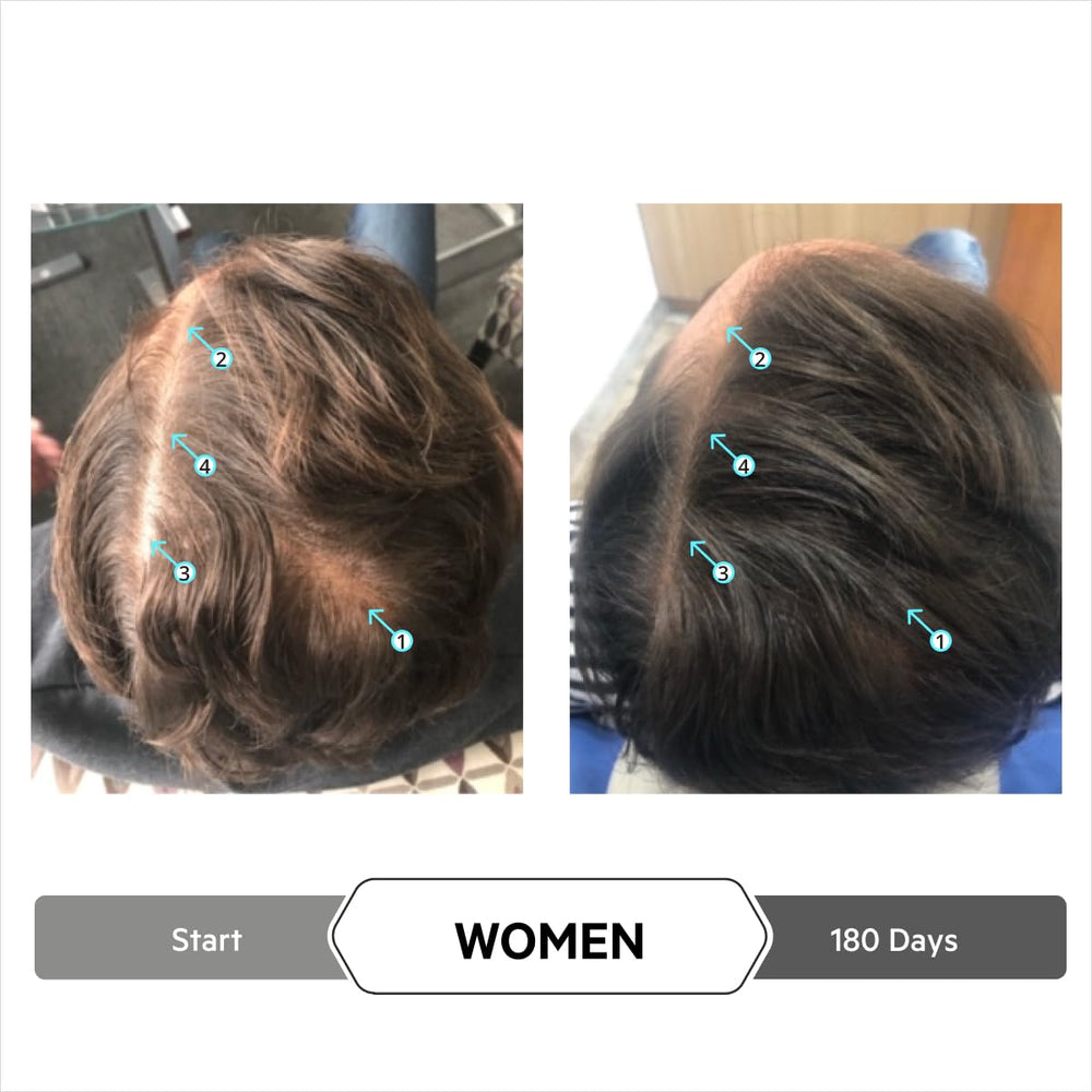 DS Laboratories Spectral Extra Strength serum drying quickly after scalp application
