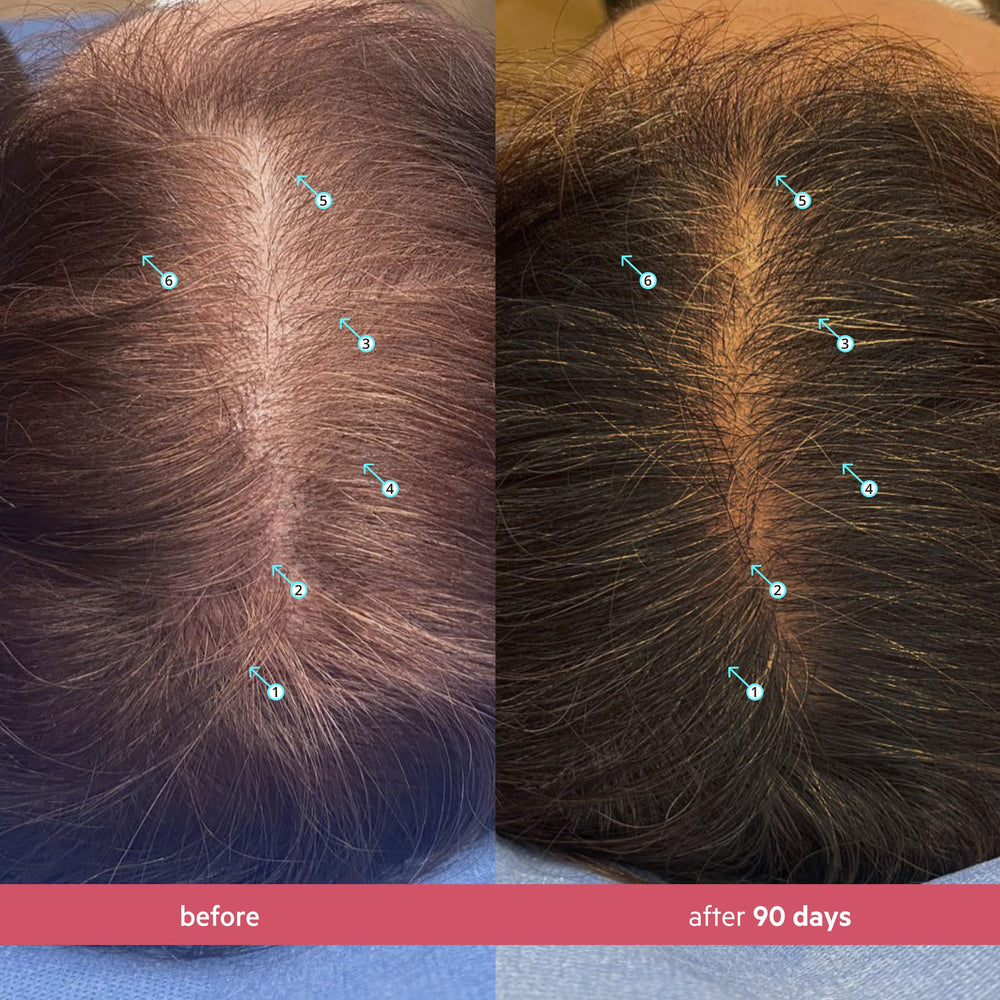 DS Labs Spectral Women's Hair Density Serum packaging shows a 60 mL bottle for regular use.