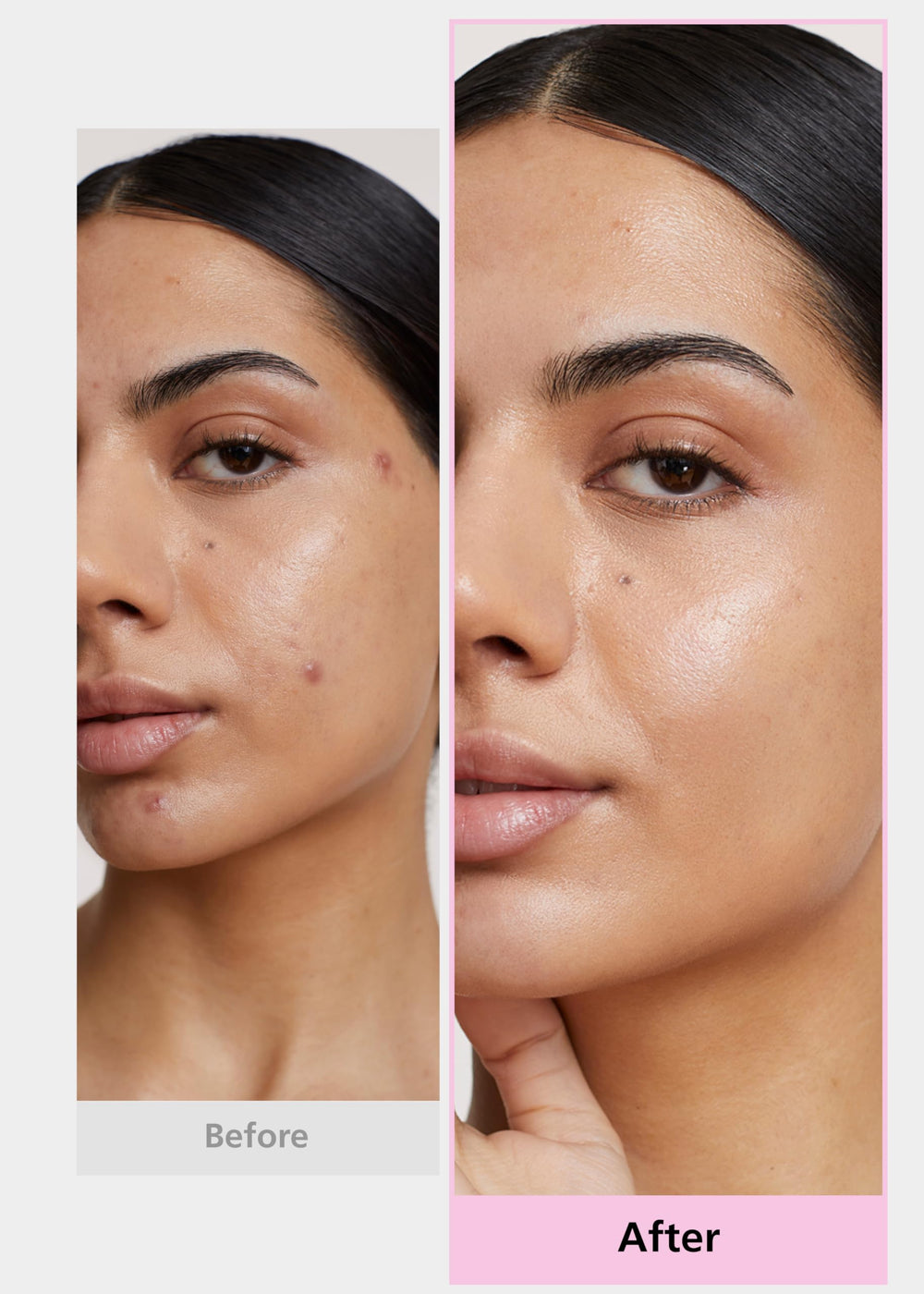 DWEasyDerm Easyderm patch dissolving technology demonstrates targeted, deeper care