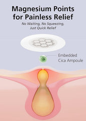 DWEasyDerm hydrocolloid acne patch protecting the spot while absorbing moisture