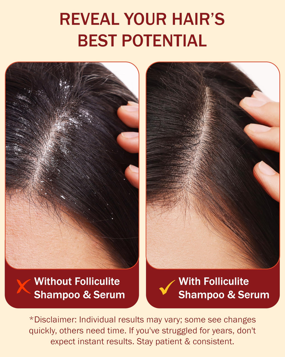e70 Aloe vera complex provides skin-friendly hydration and nourishment.