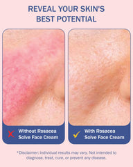 e70 10% azelaic acid bottle; targeted redness reduction in everyday use.