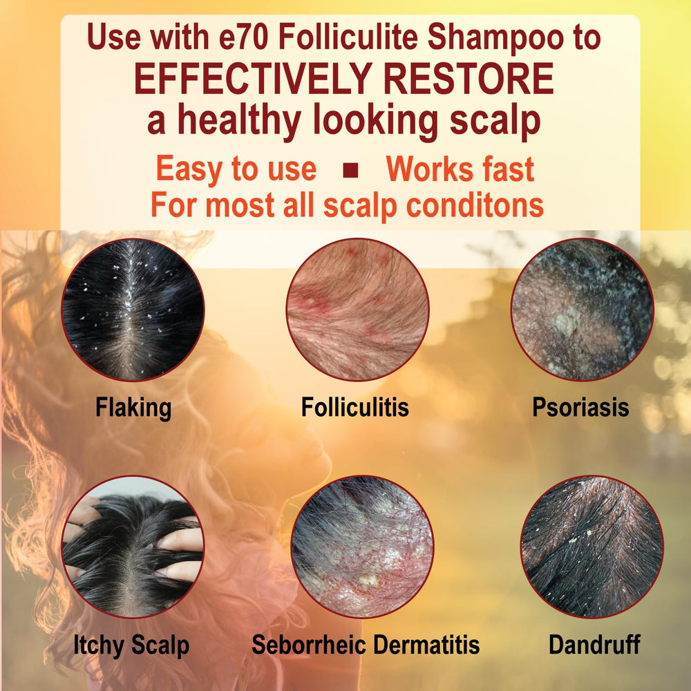 e70 Folliculitis Conditioner ingredients include tea tree and chamomile