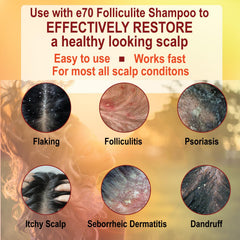 e70 Folliculitis Conditioner ingredients include tea tree and chamomile