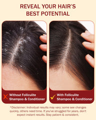 e70 Tea tree oil aloe vera ingredients highlight natural scalp care
