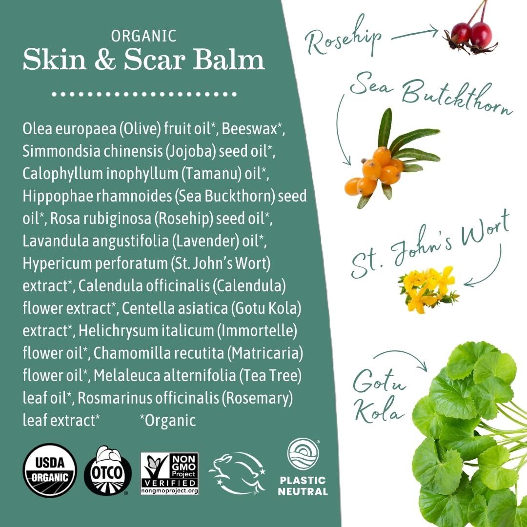 Earth Mama Organic Calendula bloom image suggests gentle support for sensitive skin.
