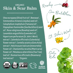 Earth Mama Organic Calendula bloom image suggests gentle support for sensitive skin.