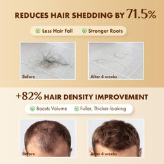 EarthShine Hair Growth Serum close-up on peptides label signaling reinforcing ingredients.