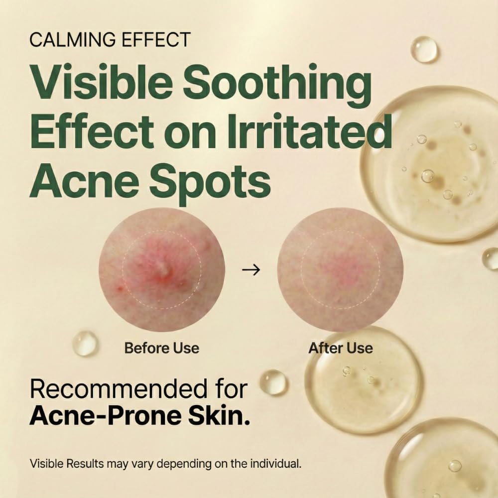 Earthward Centella Serum close-up highlights centella leaf actives delivering calmness.