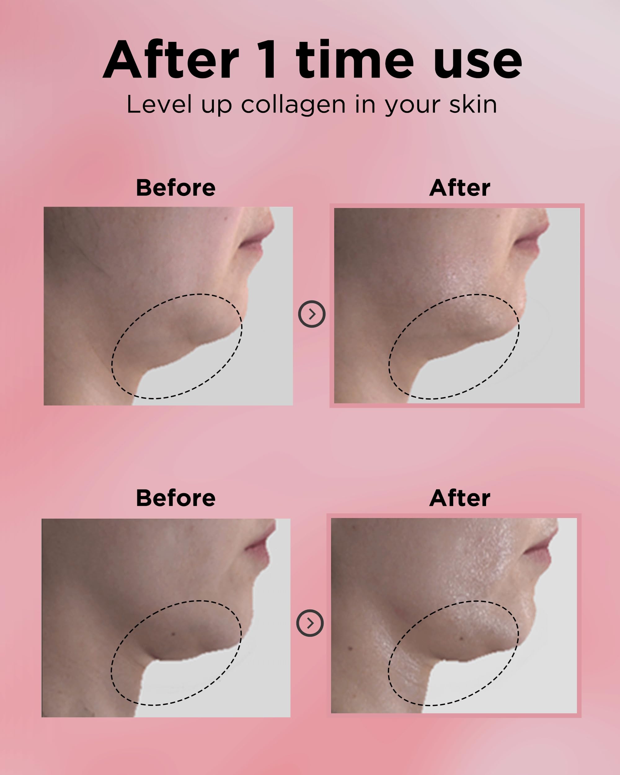 Easydew DW-EGF Silkream hydrolyzed silk supports silky skin feel.