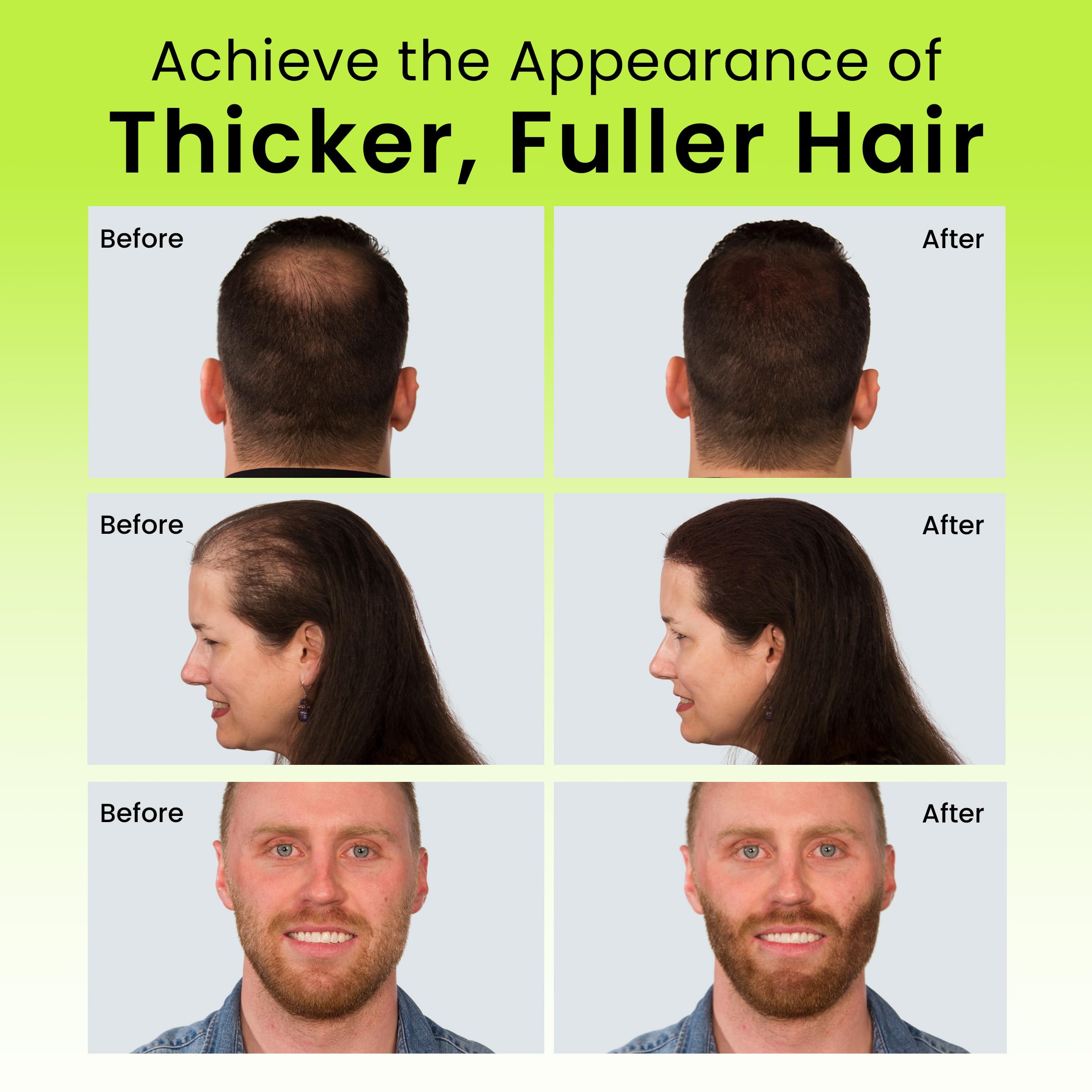 Eclipse Hair Fibers Dark Blonde application demonstrates fast thinning spot coverage.
