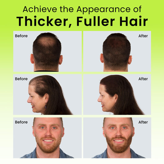 Eclipse Hair Fibers Dark Blonde application demonstrates fast thinning spot coverage.