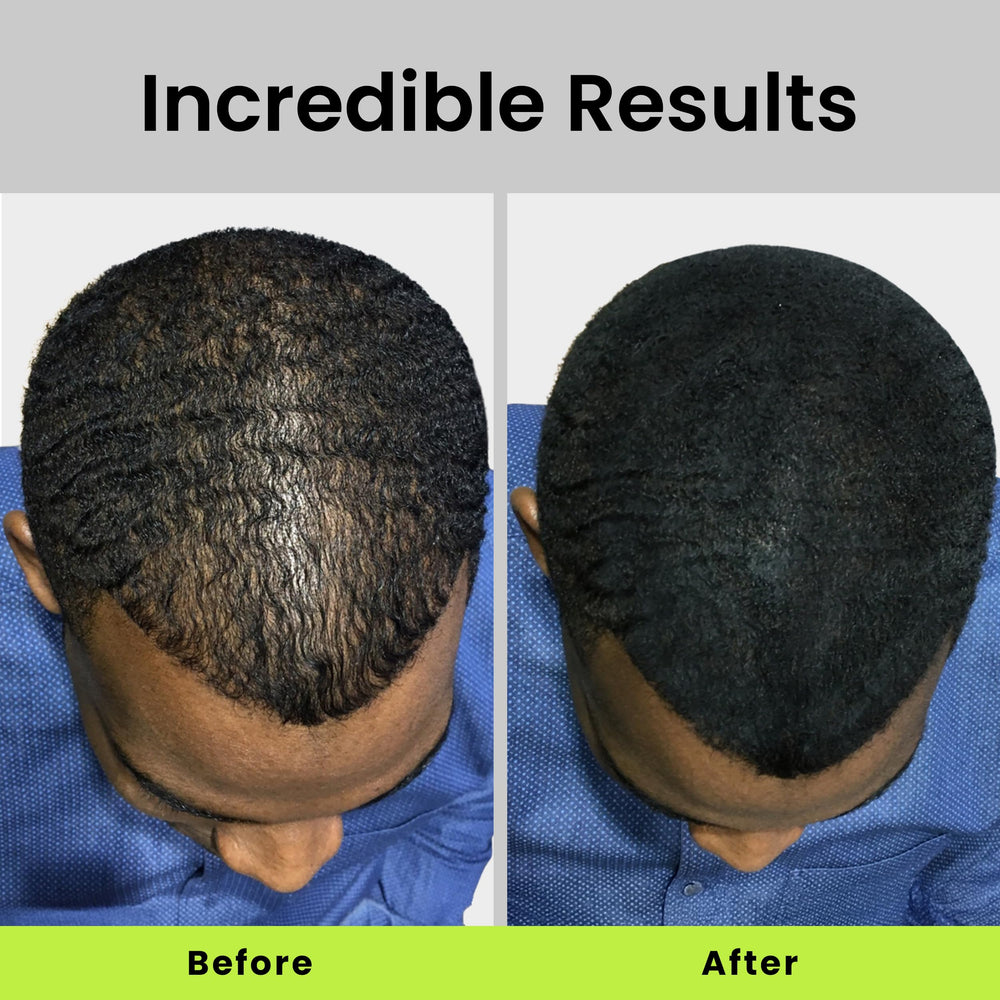 Eclipse Hair Fibers Dark Blonde instant-volume effect demonstrated after shaking.
