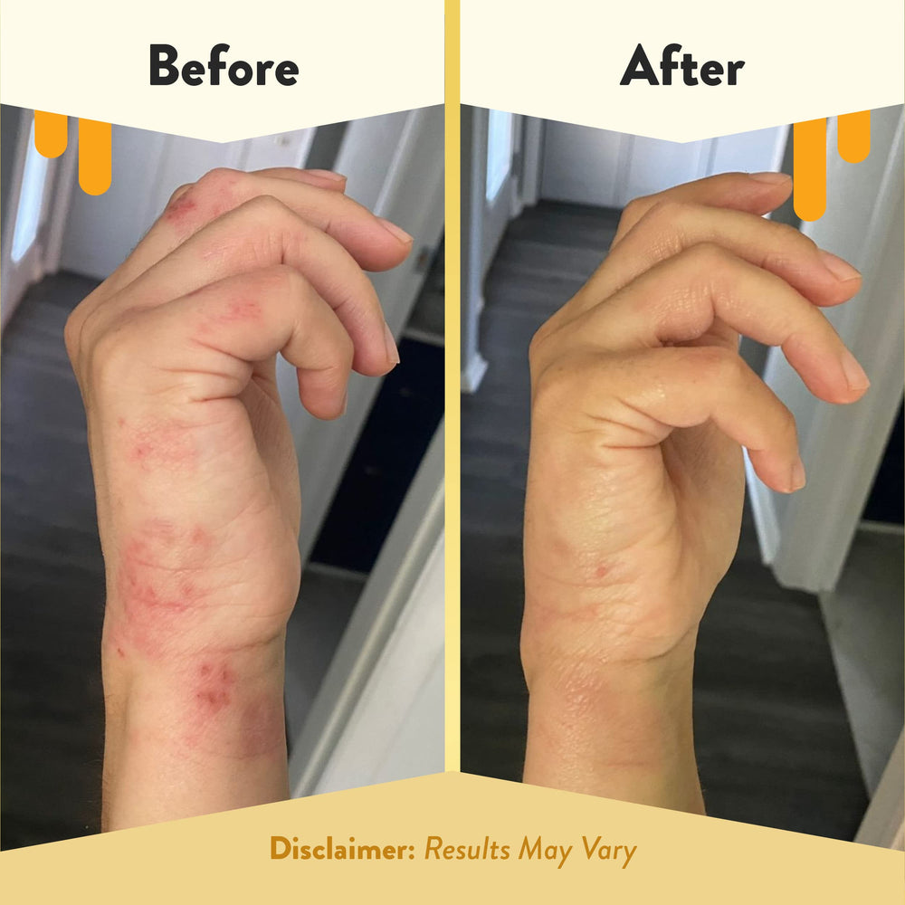 ECZEMA HONEY antioxidant body oil application on arm demonstrates quick absorption