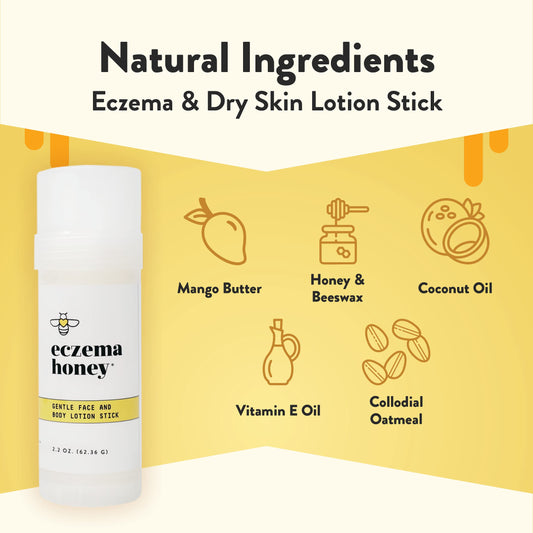 ECZEMA HONEY face application demonstrates lightweight hydration for sensitive skin