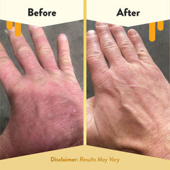 Eczema Honey foaming hand soap showing rich, moisturizing lather