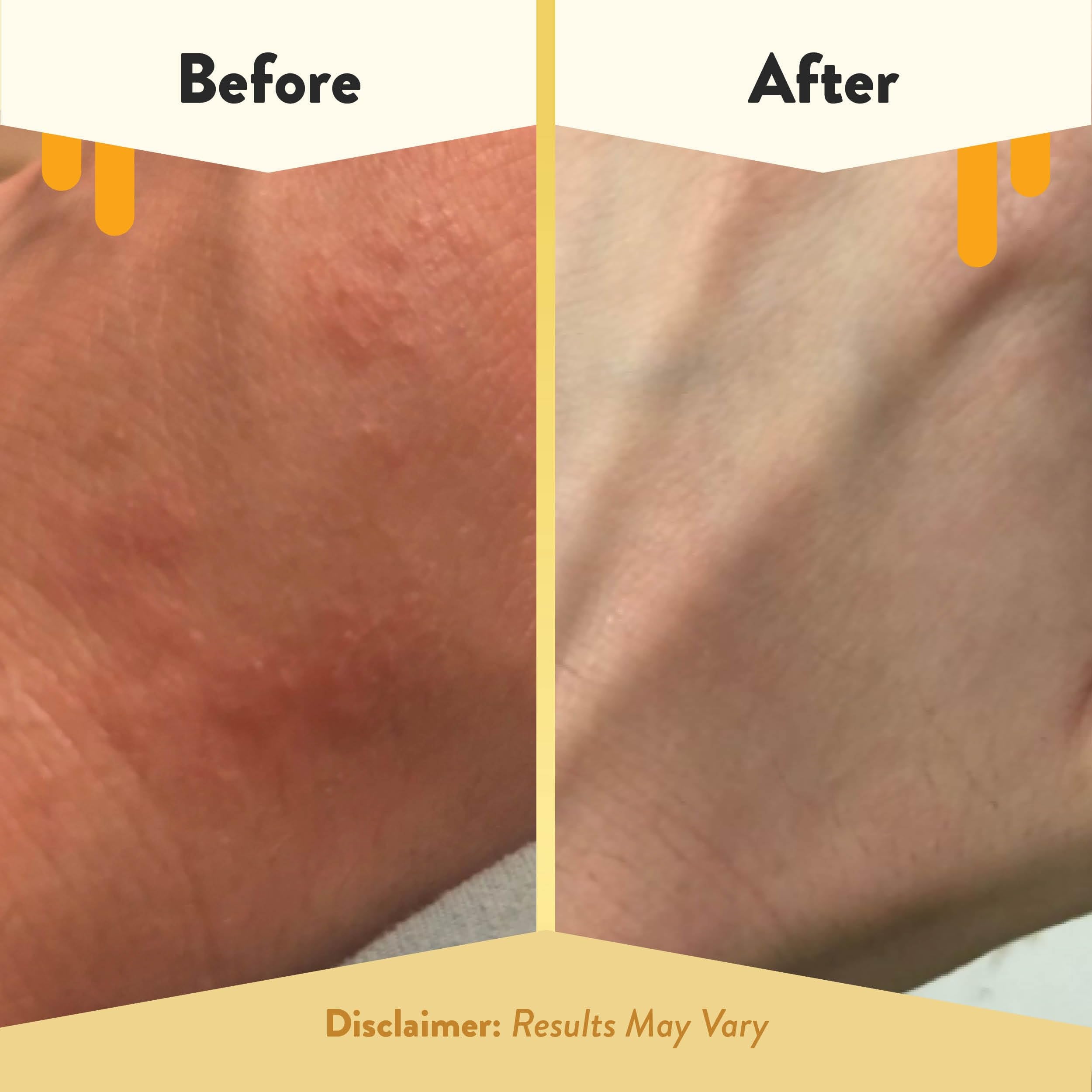 ECZEMA HONEY oatmeal body lotion texture closeup reveals lightweight, non-greasy feel