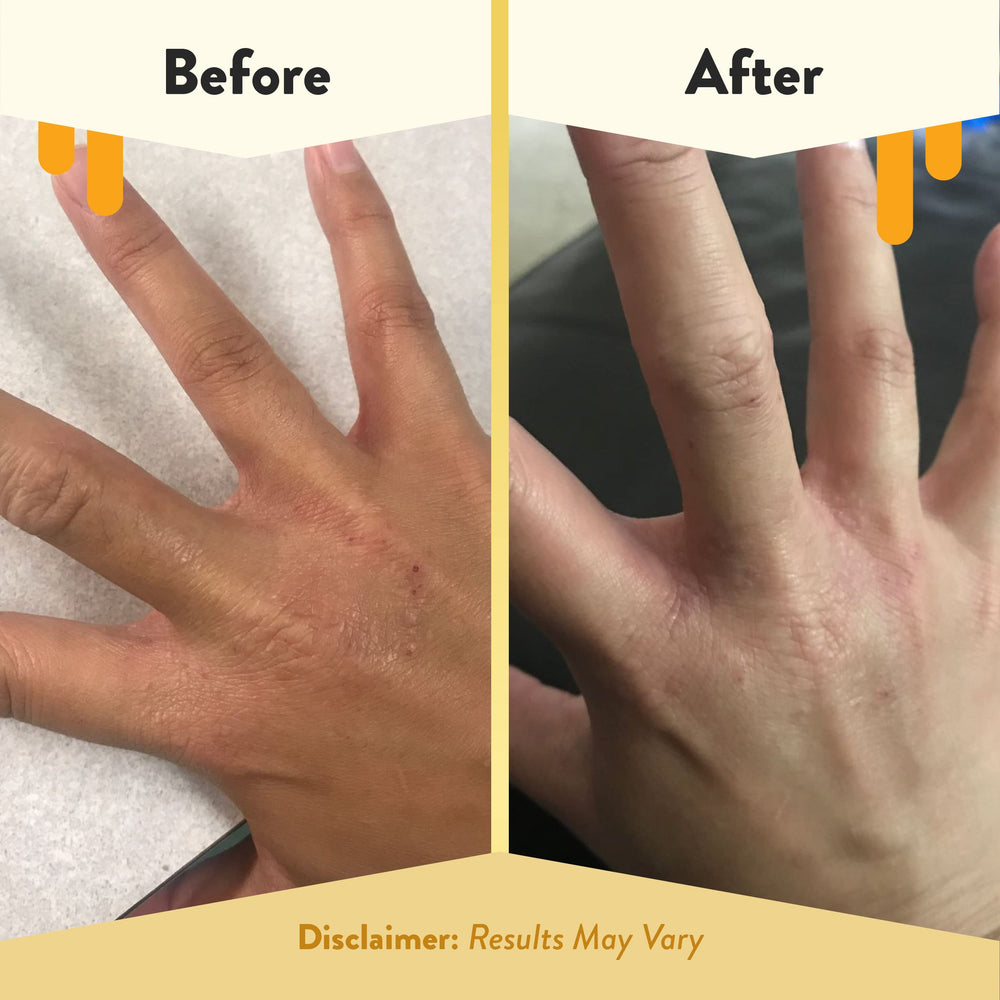 Eczema Honey Premium Witch Hazel Aloe Spray label close-up highlights a cruelty-free, unscented formula.