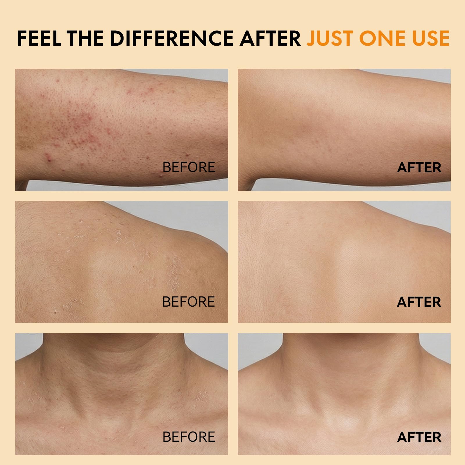 Close-up of improved skin texture using Kojic and Turmeric blend.
