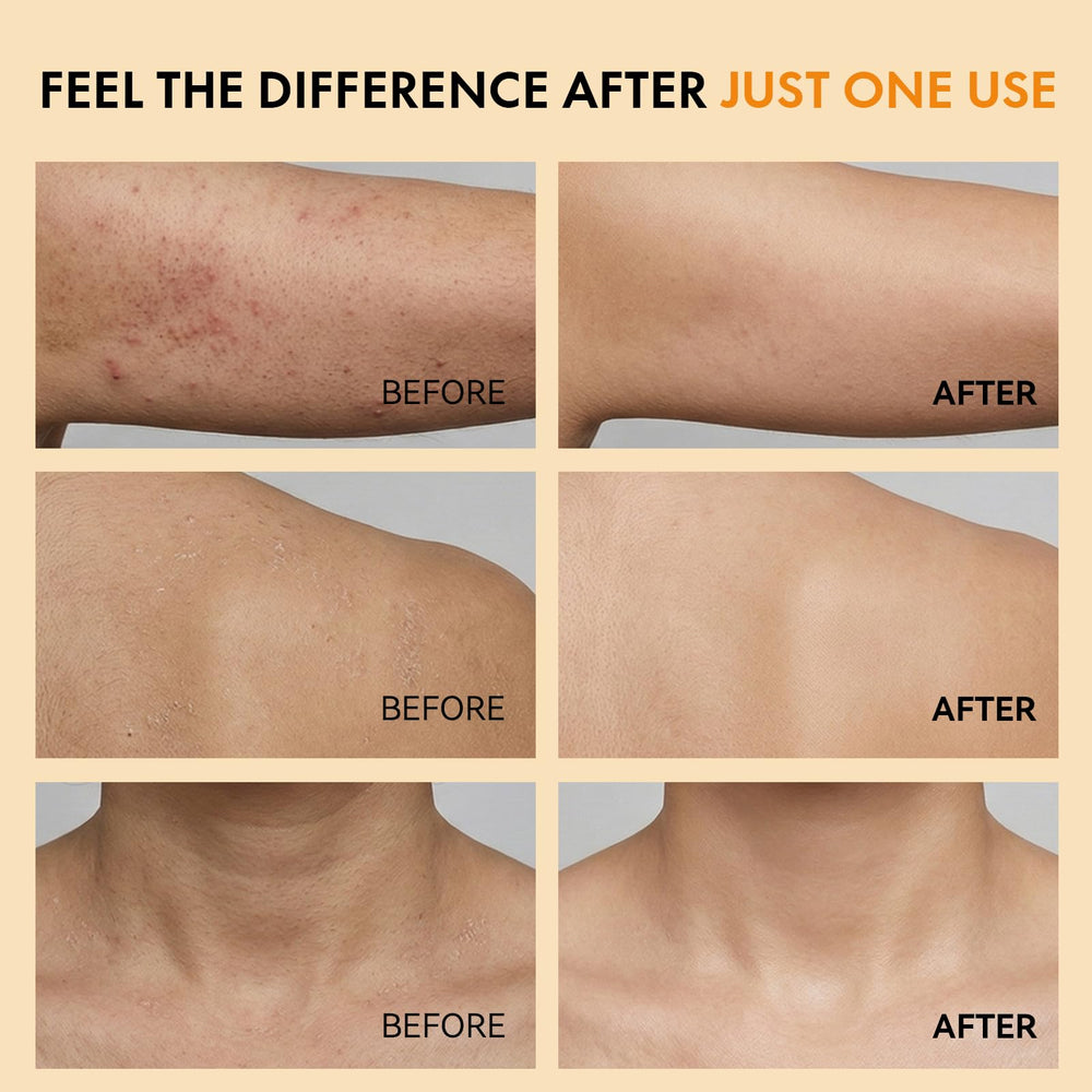 Close-up of improved skin texture using Kojic and Turmeric blend.
