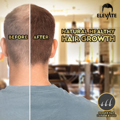 Elevate Hair Growth Oil ingredients—natural botanicals, vitamins, and essential oils.