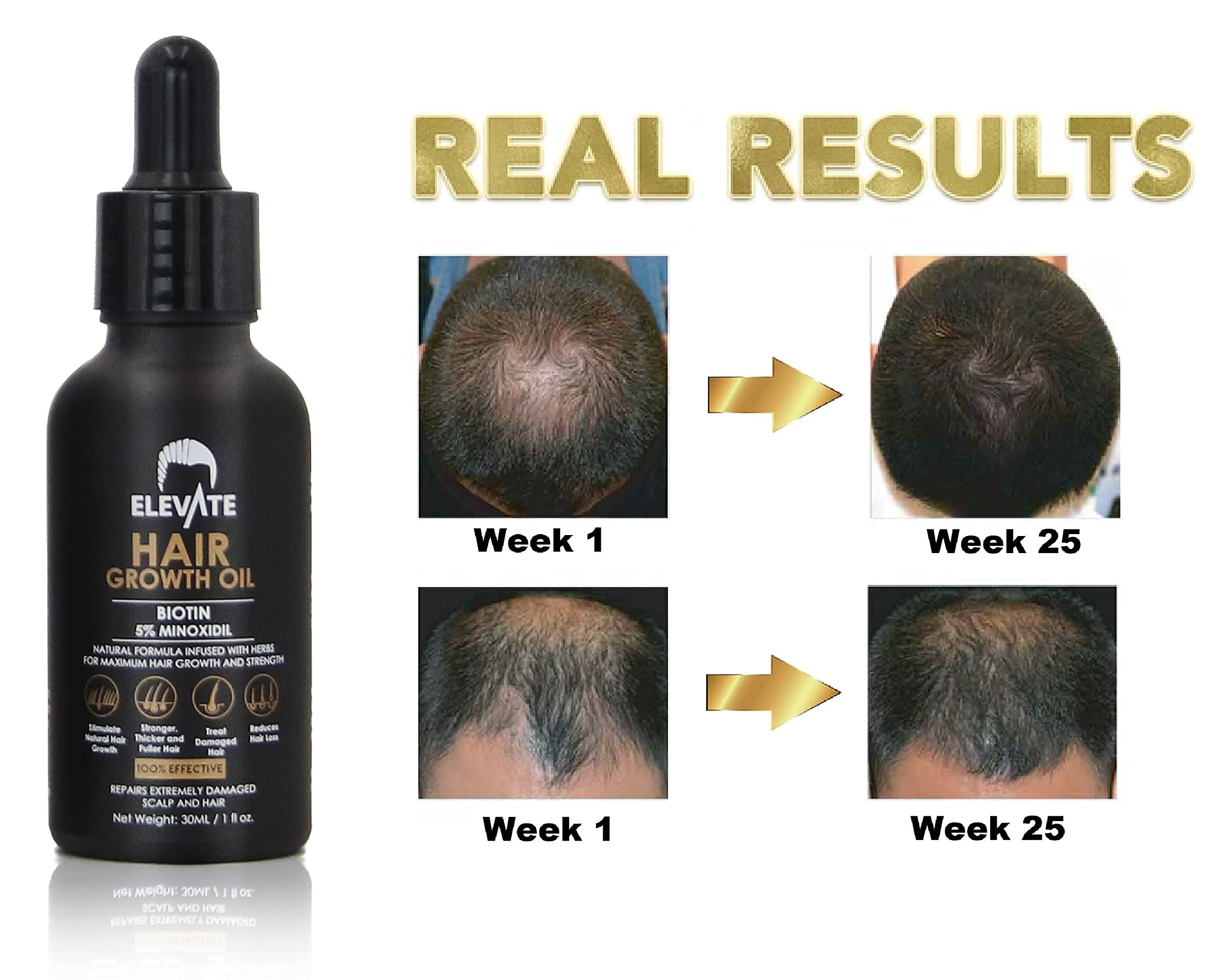 Elevate Minoxidil 5% formula closeup highlights design and ingredients
