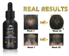 Elevate Minoxidil 5% formula closeup highlights design and ingredients