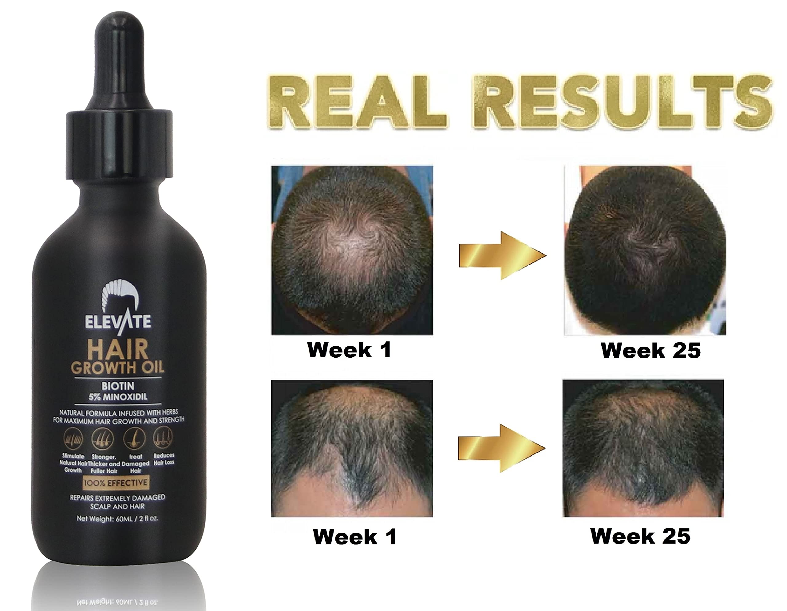 Elevate Packaging 2oz Bottle; value size for extended treatment.