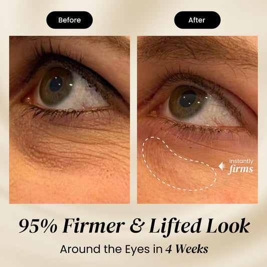 Gently applying Eliré eye cream under the eye for smoothing.