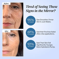 Eliré skin-firming close-up illustrates taut, smoother-looking complexion.