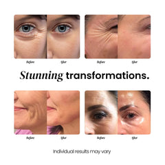 Eliré Vitamin C Aloe image highlights deep hydration and potential brightness support.