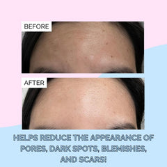 Elizabeth Mott snail mucin serum night routine step with other products.