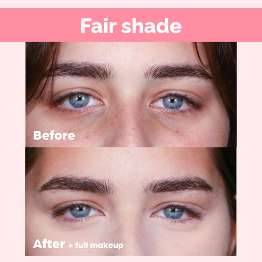 Elizabeth Mott Thank Me Later doe-foot applicator applying precise under-eye hydration.