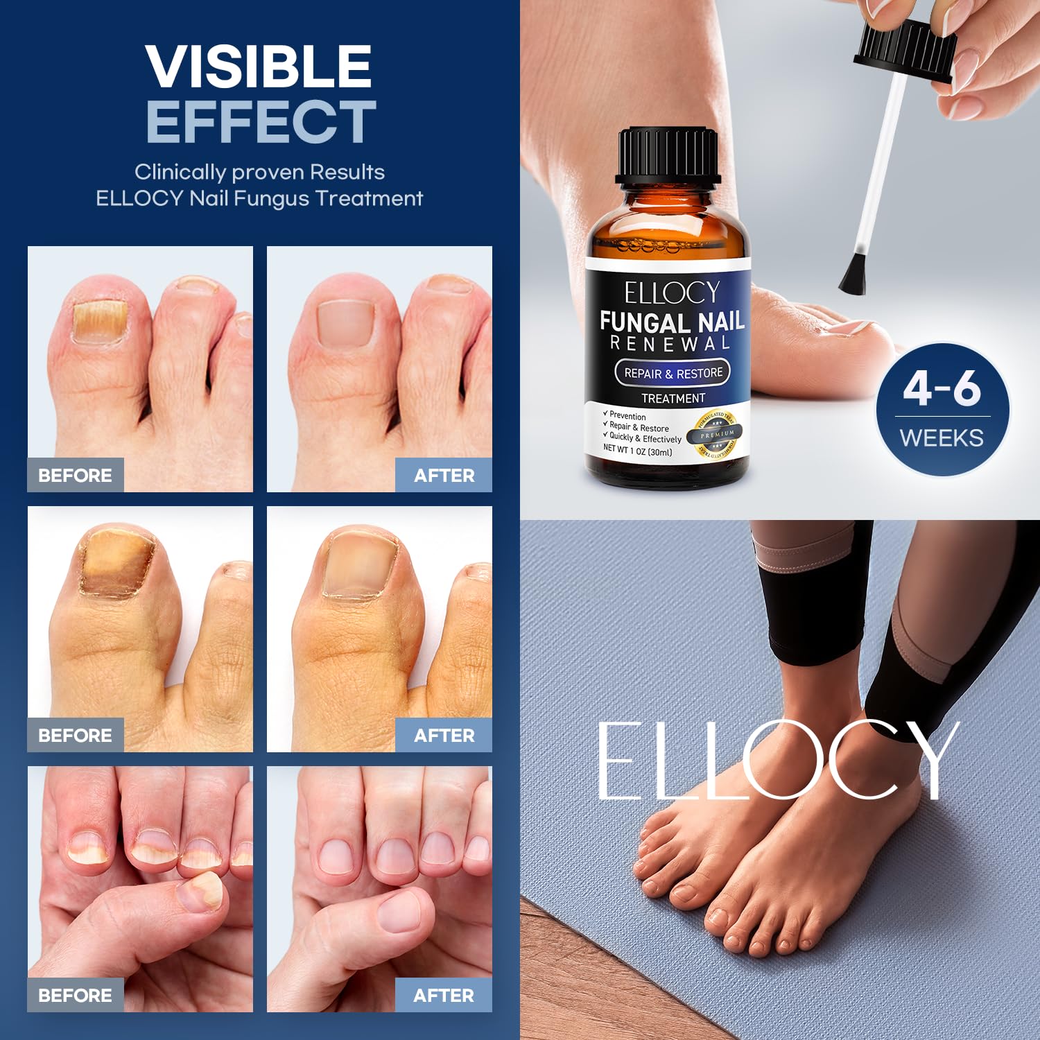 Fingernail and toenail surface after use with smoother texture.