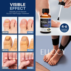 Fingernail and toenail surface after use with smoother texture.
