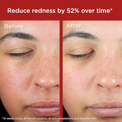 Post-procedure care with EltaMD mineral sunscreen protecting delicate skin