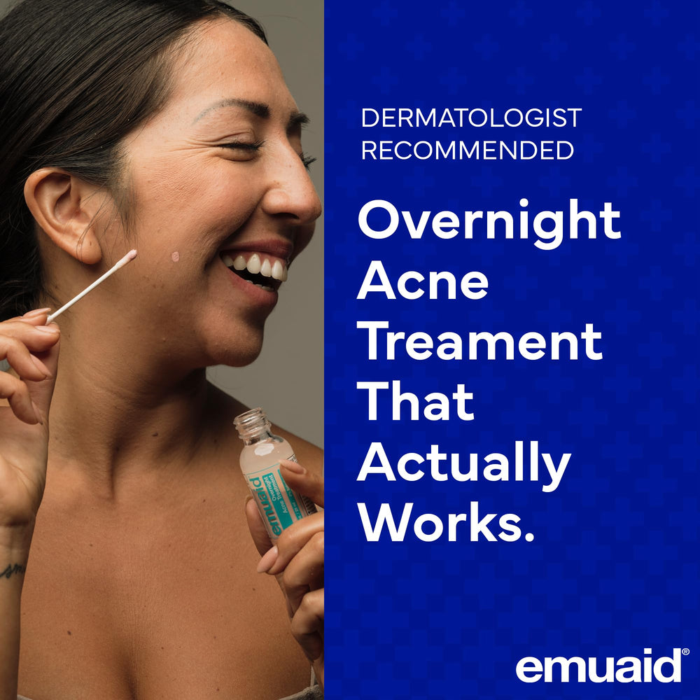 Close-up of EMUAID tube dispensing acne treatment for easy nightly application