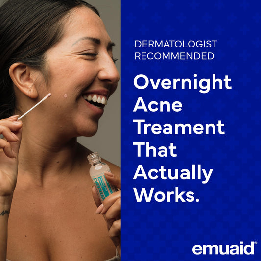 Close-up of EMUAID tube dispensing acne treatment for easy nightly application