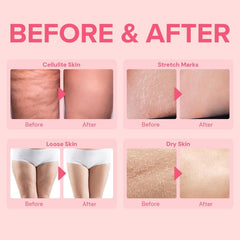 Enaskin Naturals anti-cellulite cream bottle label close-up, clean, skin-safe formula.